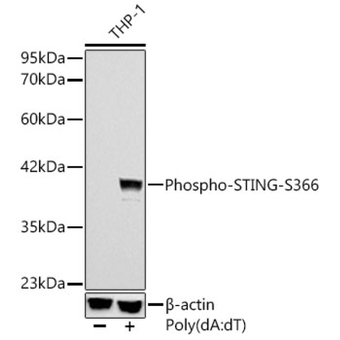 Phospho-STING/TMEM173-S366 Rabbit Monoclonal Antibody