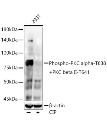 Phospho-PKC alpha-T638 + PKC beta II-T641 Rabbit Monoclonal Antibody