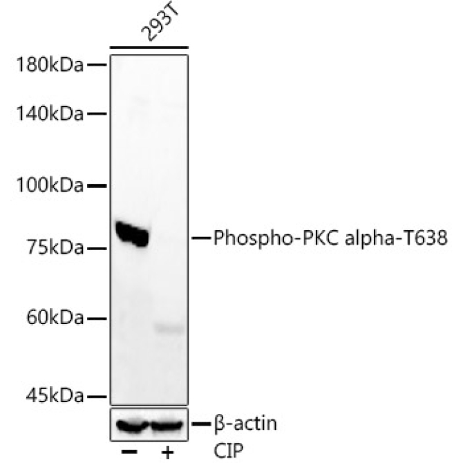 Phospho-PKC alpha-T638 Rabbit Monoclonal Antibody