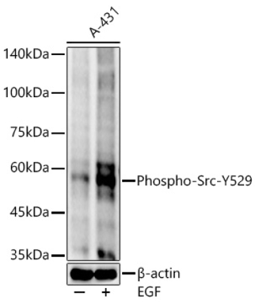 Phospho-Src-Y529 Rabbit Monoclonal Antibody