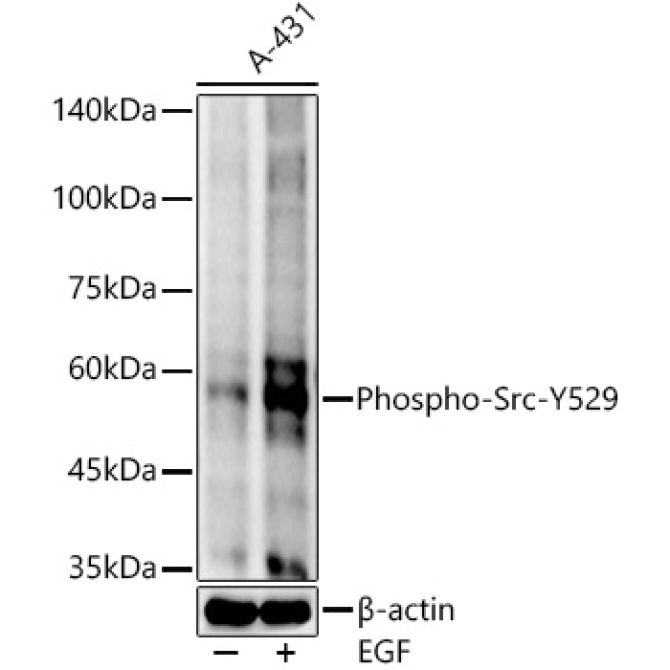 Phospho-Src-Y529 Rabbit Monoclonal Antibody