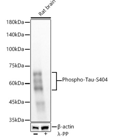 Phospho-Tau-S404 Rabbit Monoclonal Antibody