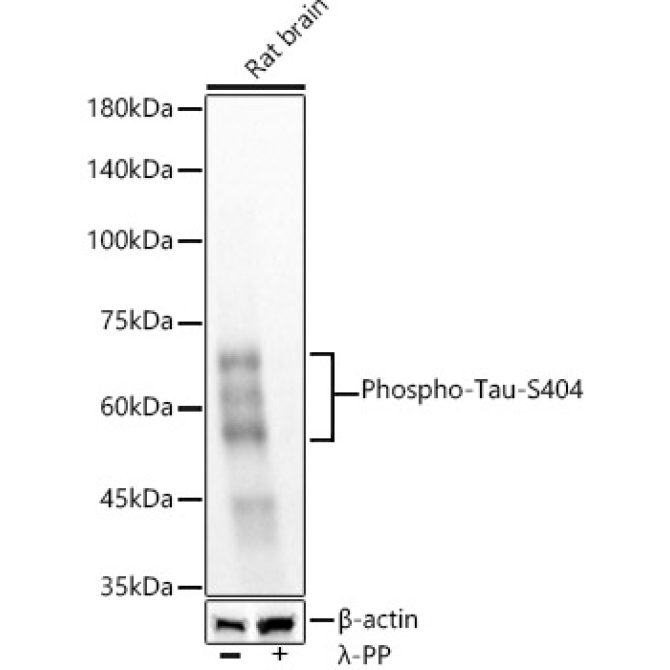 Phospho-Tau-S404 Rabbit Monoclonal Antibody