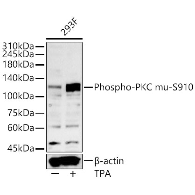 Phospho-PKC mu-S910 Rabbit Polyclonal Antibody