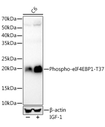 Phospho-eIF4EBP1-T37 Rabbit Monoclonal Antibody