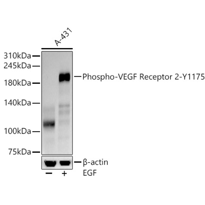 Phospho-VEGF Receptor 2-Y1175 Rabbit Monoclonal Antibody