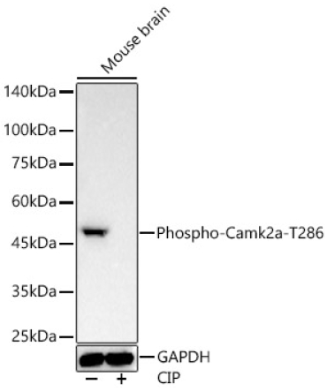 Phospho-Camk2-T286 Rabbit Monoclonal Antibody