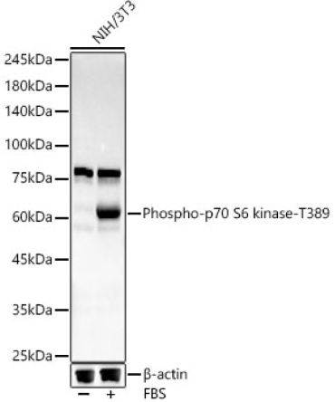 Phospho-p70 S6 kinase-T389 Rabbit Monoclonal Antibody