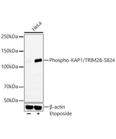 Phospho-KAP1/TRIM28-S824 Rabbit Monoclonal Antibody