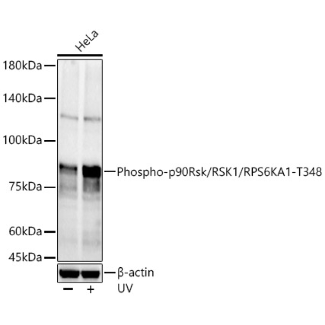 Phospho-p90Rsk/RSK1/RPS6KA1-T348 Rabbit Polyclonal Antibody