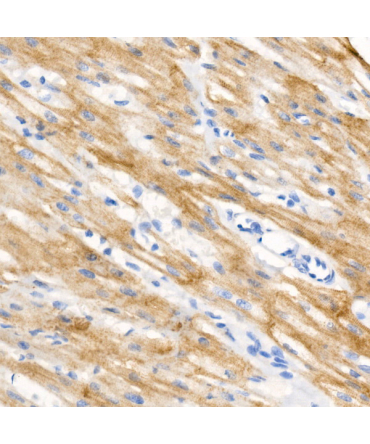 Phospho-Cardiac Troponin I (TNNI3)-S23/S24 Rabbit Monoclonal Antibody