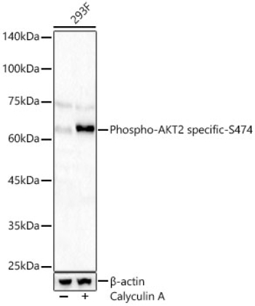 Phospho-AKT2 specific-S474 Rabbit Polyclonal Antibody