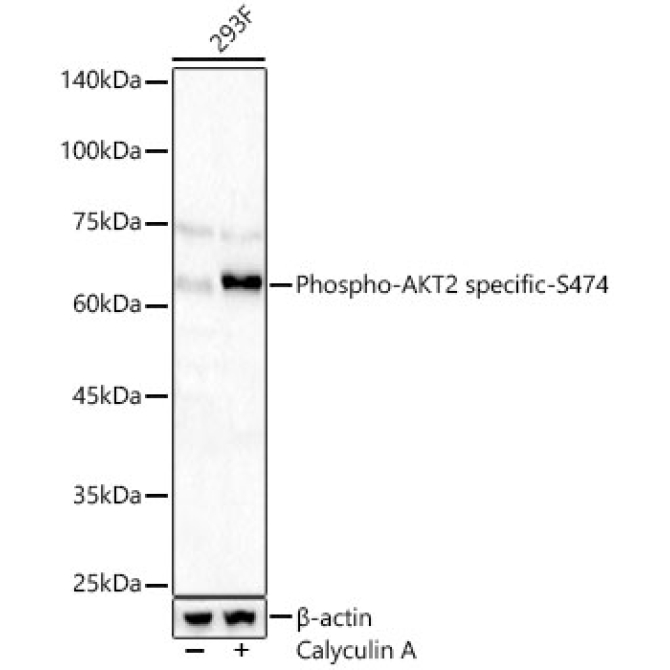 Phospho-AKT2 specific-S474 Rabbit Polyclonal Antibody