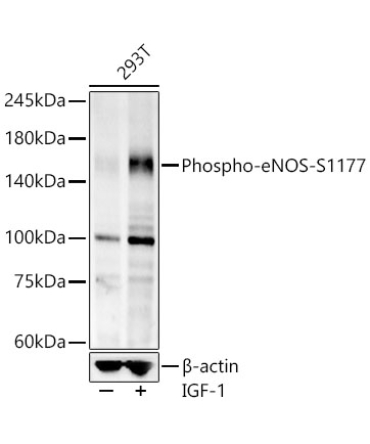 Phospho-eNOS-S1177 Rabbit Monoclonal Antibody