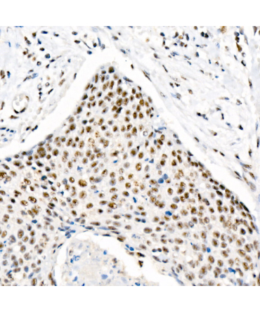 Phospho-Chk2-T68 Rabbit Monoclonal Antibody