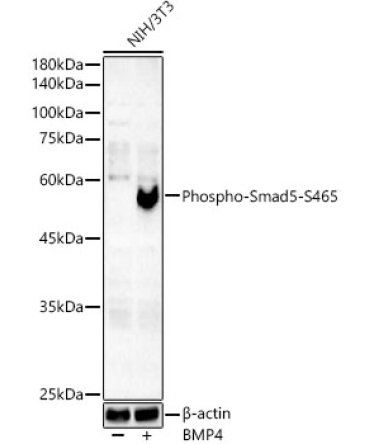 Phospho-Smad5-S465 Rabbit Monoclonal Antibody