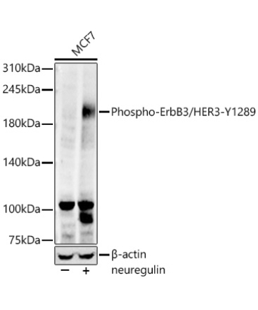 Phospho-ErbB3/HER3-Y1289 Rabbit Monoclonal Antibody