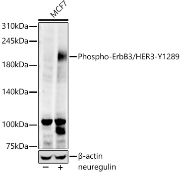 Phospho-ErbB3/HER3-Y1289 Rabbit Monoclonal Antibody