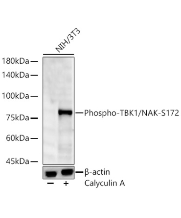 Phospho-TBK1/NAK-S172 Rabbit Monoclonal Antibody