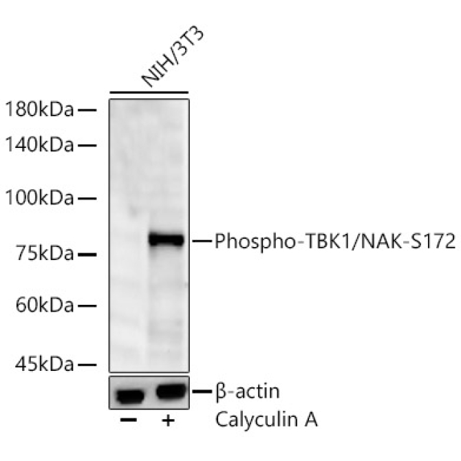 Phospho-TBK1/NAK-S172 Rabbit Monoclonal Antibody