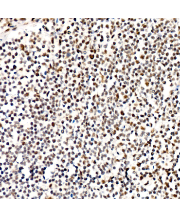 Phospho-PERK-T982 Rabbit Monoclonal Antibody