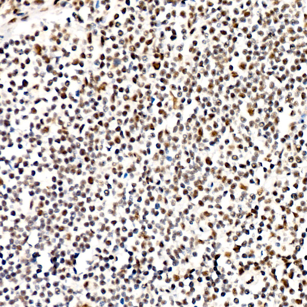 Phospho-PERK-T982 Rabbit Monoclonal Antibody