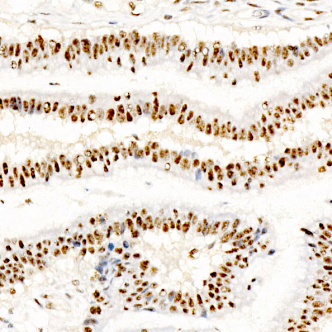 Phospho-CREB1-S133 Rabbit Monoclonal Antibody