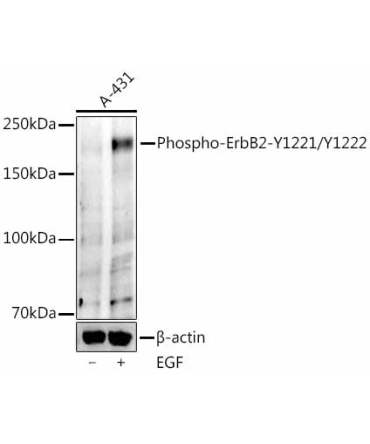 Phospho-ErbB2-Y1221/Y1222 Rabbit Monoclonal Antibody