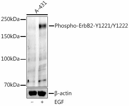 Phospho-ErbB2-Y1221/Y1222 Rabbit Monoclonal Antibody