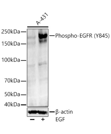 Phospho-EGFR-Y845 Rabbit Monoclonal Antibody