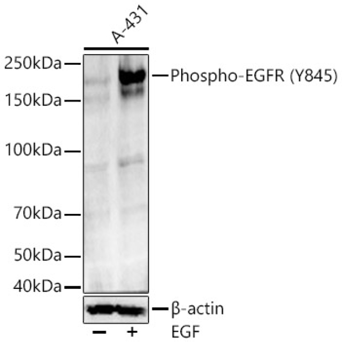 Phospho-EGFR-Y845 Rabbit Monoclonal Antibody