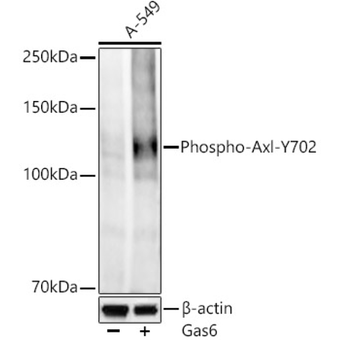 Phospho-Axl-Y702 Rabbit Monoclonal Antibody