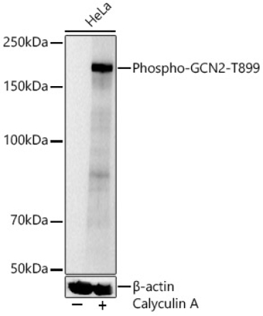 Phospho-GCN2-T899 Rabbit Polyclonal Antibody