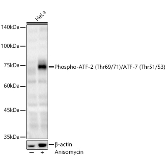 Phospho-ATF-2 (Thr69/71)/ATF-7 (Thr51/53) Rabbit Polyclonal Antibody