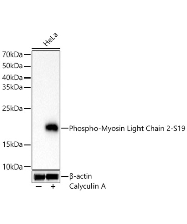 Phospho-Myosin Light Chain 2-S19 Rabbit Monoclonal Antibody