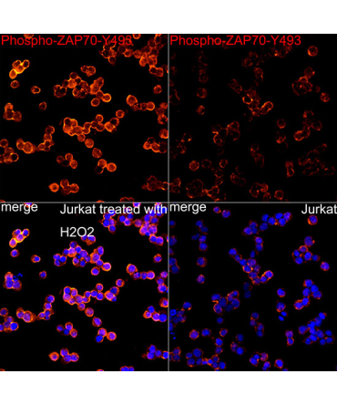 Phospho-ZAP70-Y493 Rabbit Monoclonal Antibody
