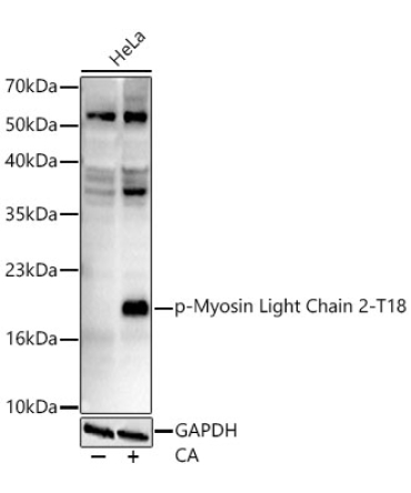 Phospho-Myosin Light Chain 2-T18 Rabbit Monoclonal Antibody