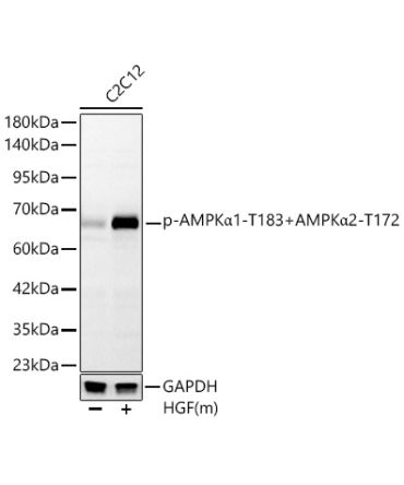 Phospho-AMPKAlpha1-T183+AMPKAlpha2-T172 Rabbit Monoclonal Antibody