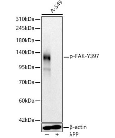 Phospho-FAK-Y397 Rabbit Monoclonal Antibody