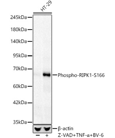 Phospho-RIPK1-S166 Rabbit Monoclonal Antibody