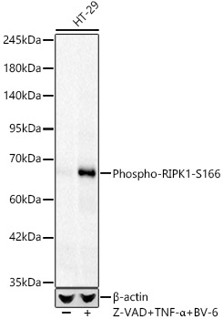 Phospho-RIPK1-S166 Rabbit Monoclonal Antibody