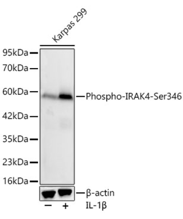 Phospho-IRAK4-Ser346 Rabbit Monoclonal Antibody