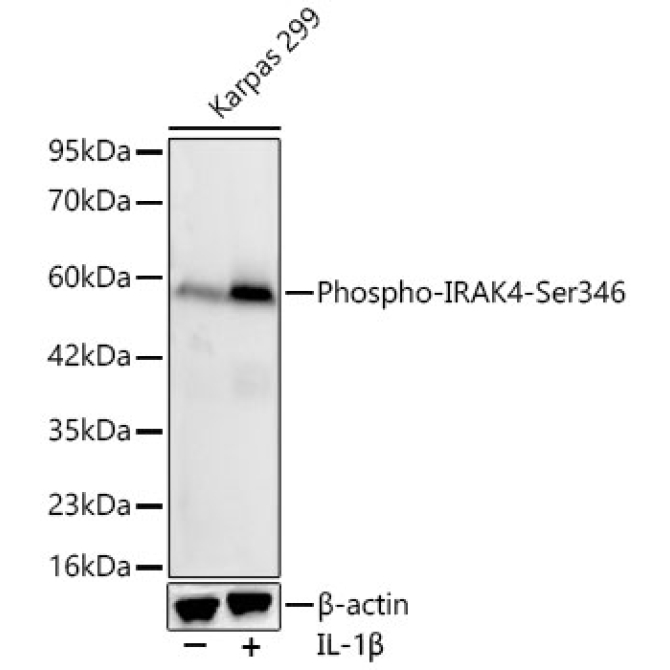 Phospho-IRAK4-Ser346 Rabbit Monoclonal Antibody