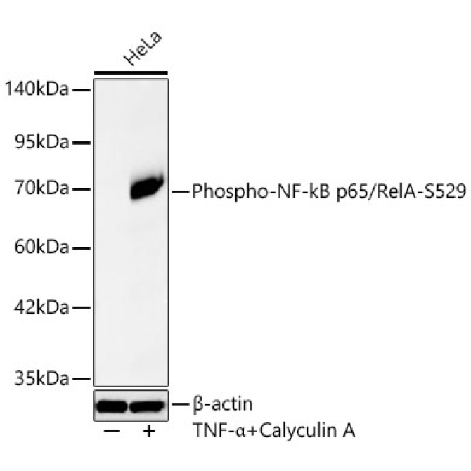 Phospho-NF-kB p65/RelA-S529 Rabbit Monoclonal Antibody