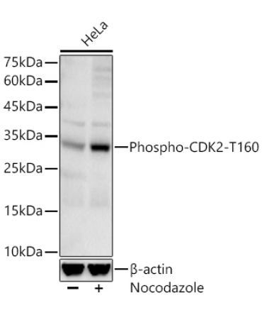 Phospho-CDK2-T160 Rabbit Monoclonal Antibody