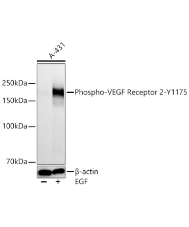 Phospho-VEGF Receptor 2-Y1175 Rabbit Monoclonal Antibody