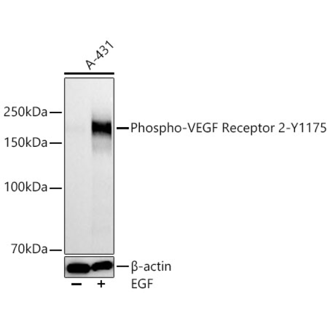 Phospho-VEGF Receptor 2-Y1175 Rabbit Monoclonal Antibody
