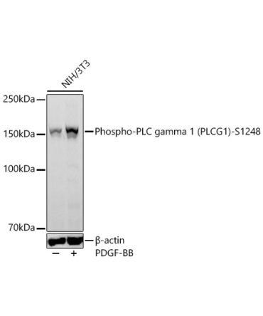 Phospho-PLC gamma 1 (PLCG1)-S1248 Rabbit Monoclonal Antibody