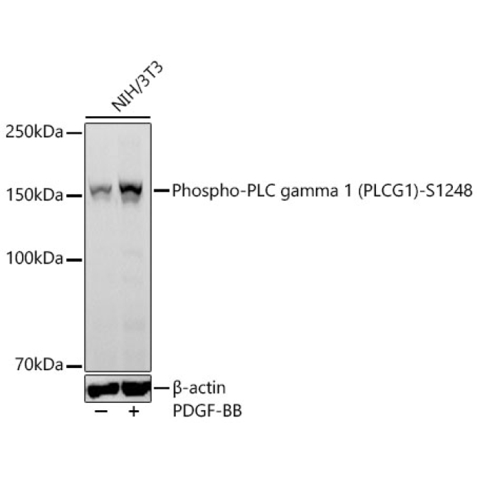 Phospho-PLC gamma 1 (PLCG1)-S1248 Rabbit Monoclonal Antibody