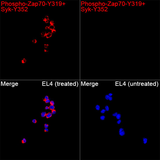 Phospho-Zap70-Y319+Syk-Y352 Rabbit Polyclonal Antibody